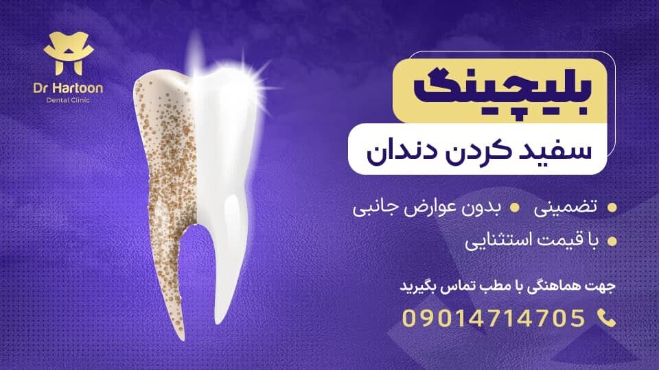 بلیچینگ دندان.jpg