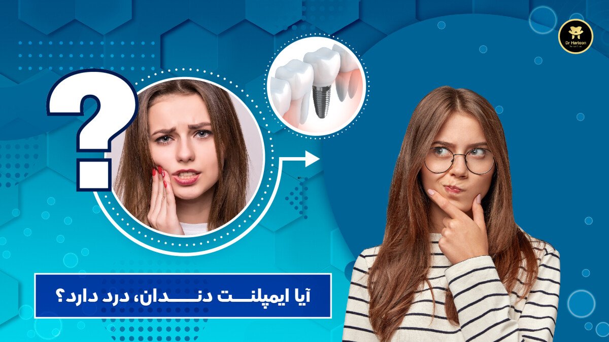 تصویرآیا ایمپلنت دندان درد دارد؟ | دکتر هرمز هارطون