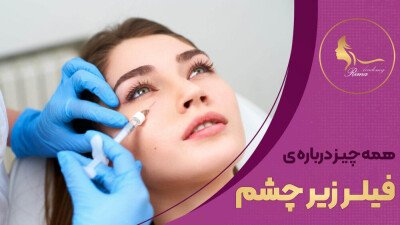 فیلر زیر چشم