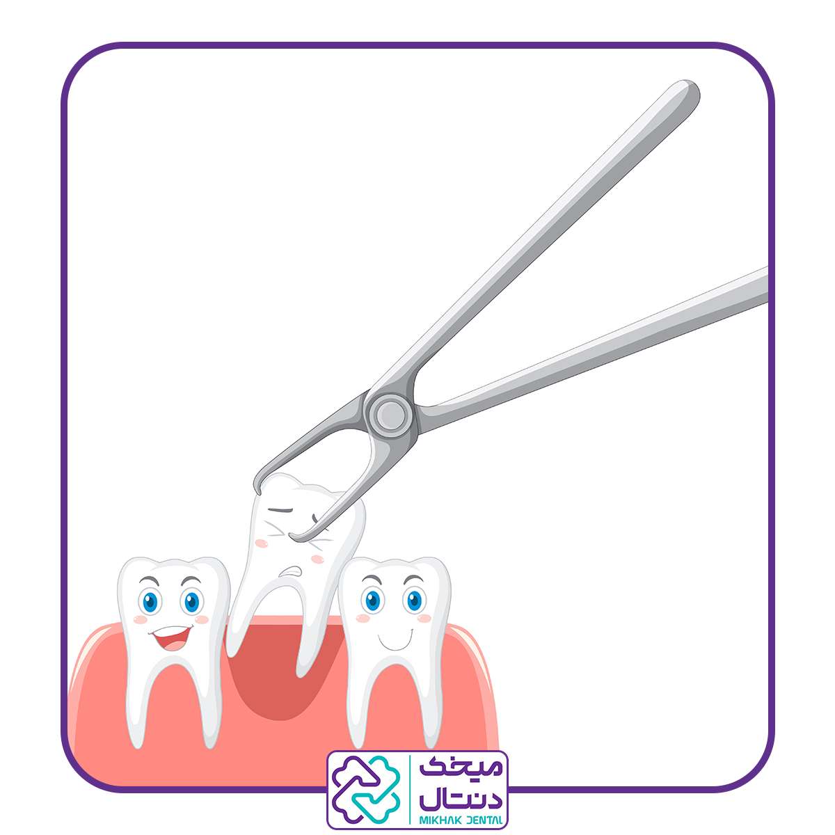 کشیدن دندان ساده