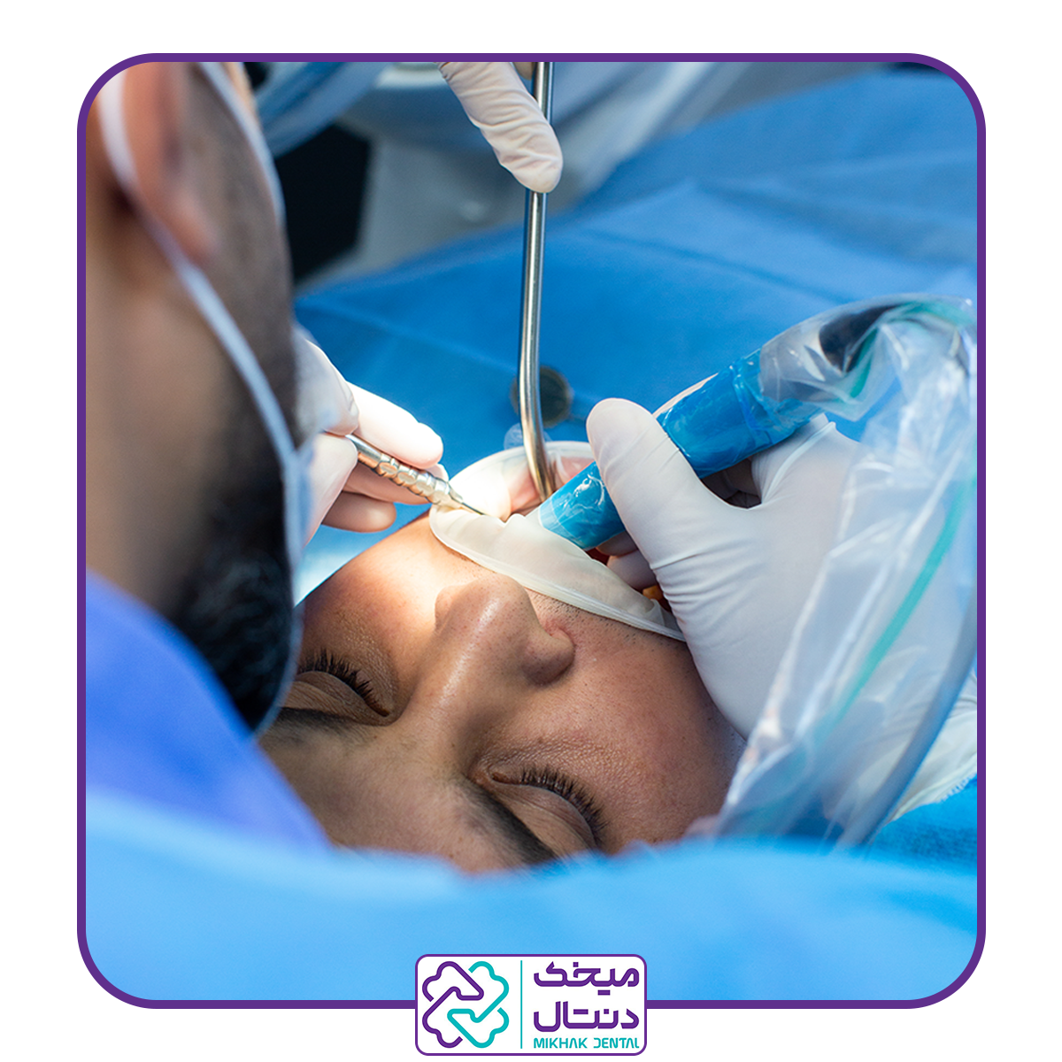 جراحی دندان