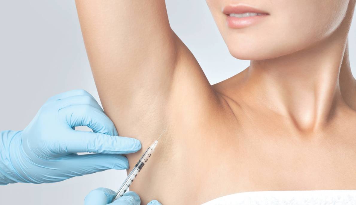 تزریق بوتاکس زیر بغل برای جلوگیری از تعریق