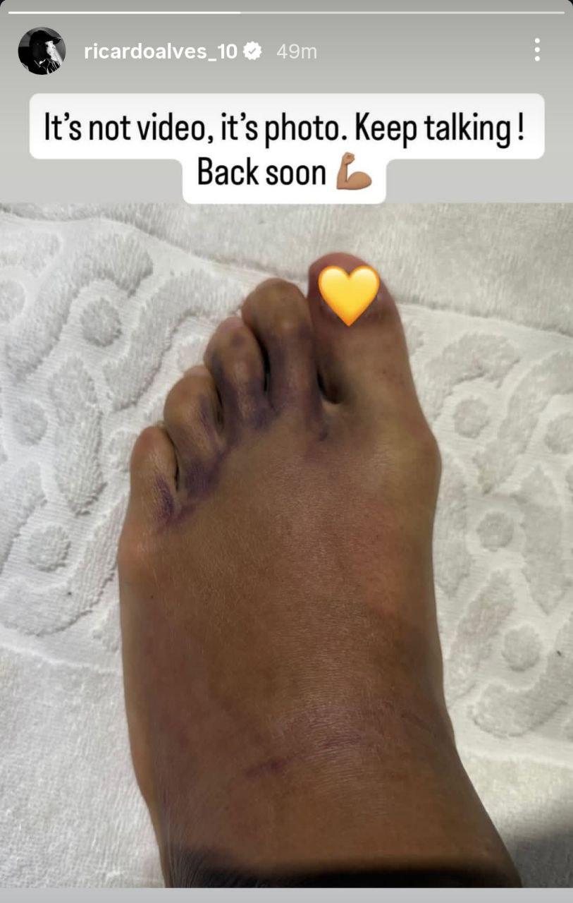 استوری ریکاردو آلوز